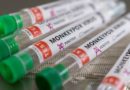 Após 1º caso no Brasil da varíola do macaco, ministério da saúde monitora nove suspeitos