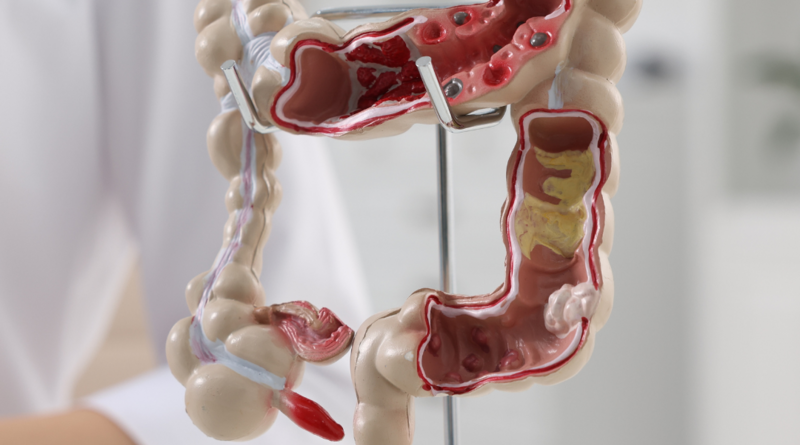 Adrian Bester lança curso on-line de modulação intestinal